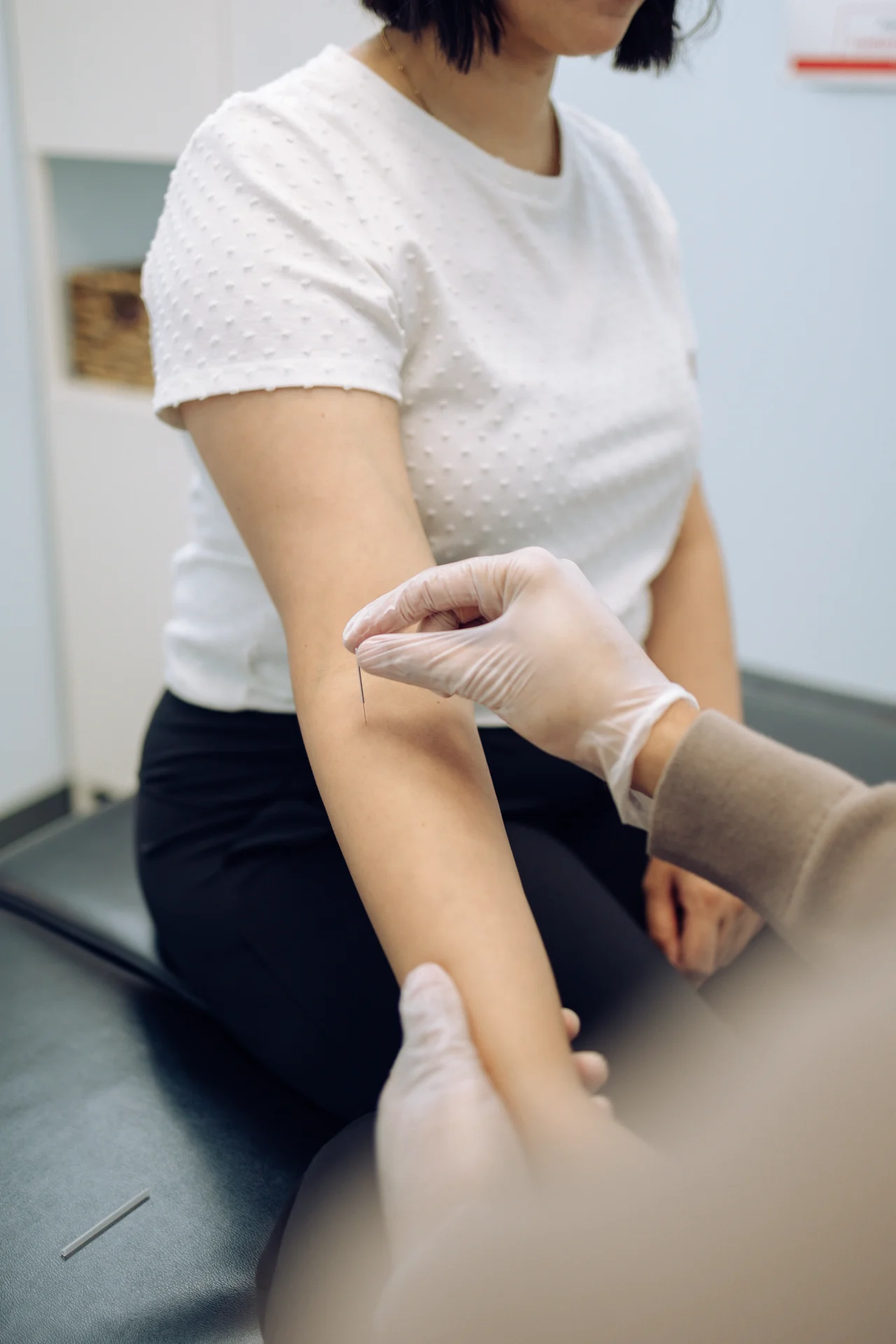 Person receiving acupuncture treatment on their arm in a clinical setting.